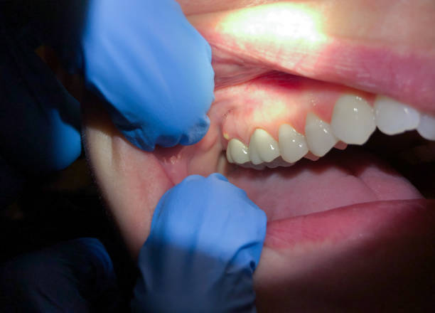 Best Emergency Treatment for Jaw Pain or Injury in Rochester, WA